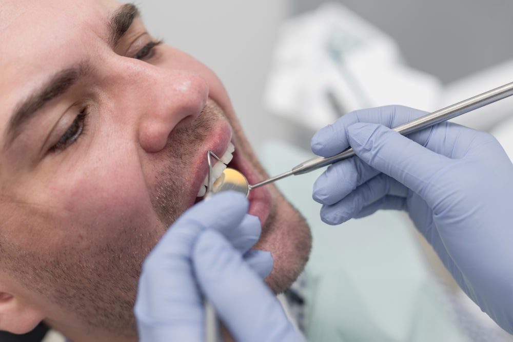 When Do You Need a Tooth Extraction?