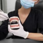 Why Would You Need a Bone Graft in Your Jaw