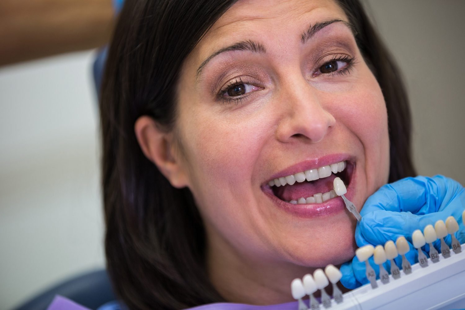 Do Dental Implants Look Like Real Teeth?