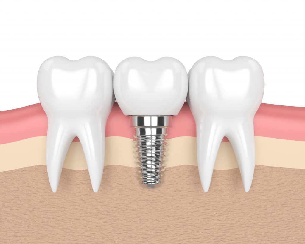 What is Oral Surgery?