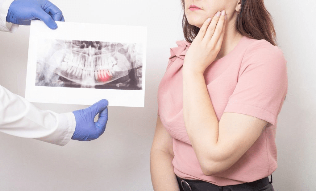 Wisdom tooth pain relief at Topeka Oral Surgery