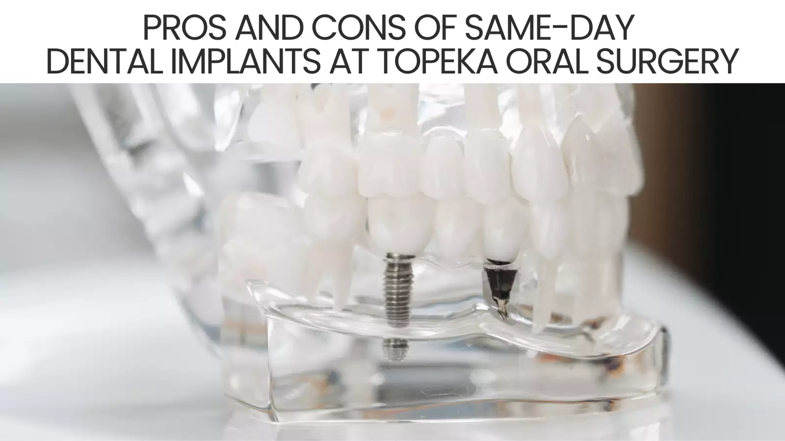 Pros and Cons of Same-Day Dental Implants at Topeka Oral Surgery