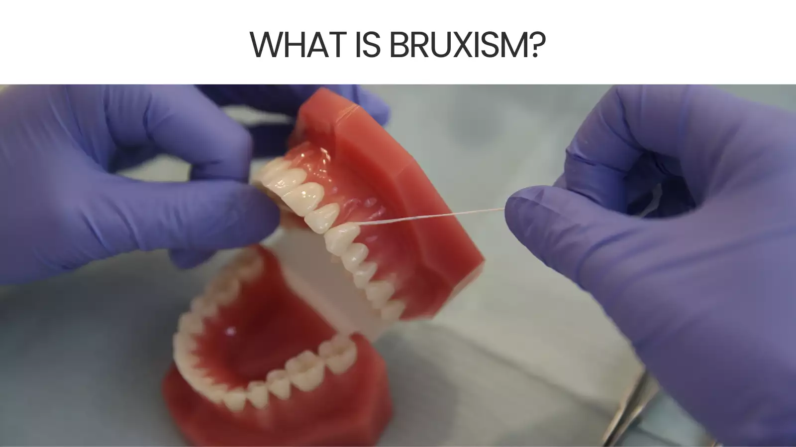 What Is Bruxism?