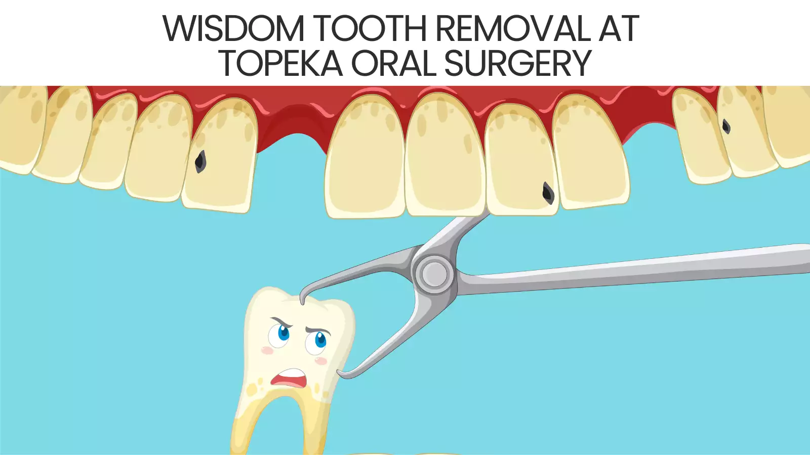 Wisdom Tooth Removal at Topeka Oral Surgery