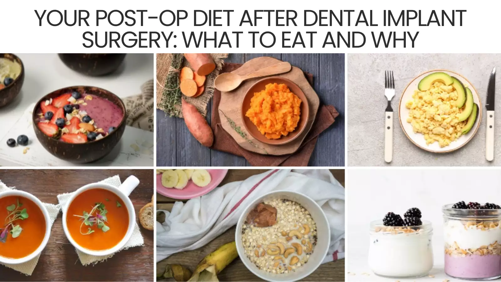 Your Post-Op Diet After Dental Implant Surgery: What to Eat and Why